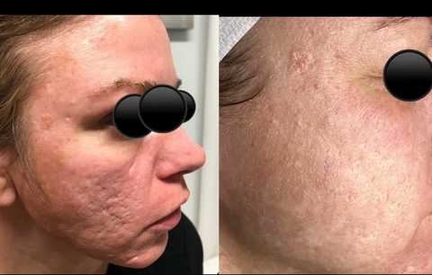 gallery image in our gallery