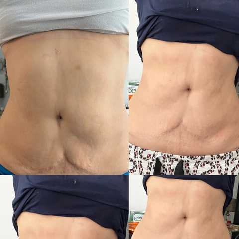 gallery image in our gallery