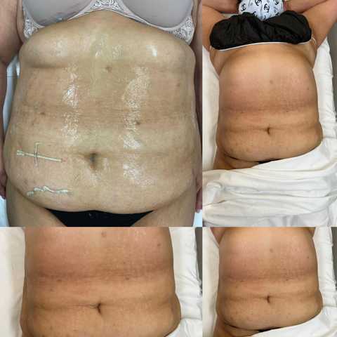 gallery image in our gallery