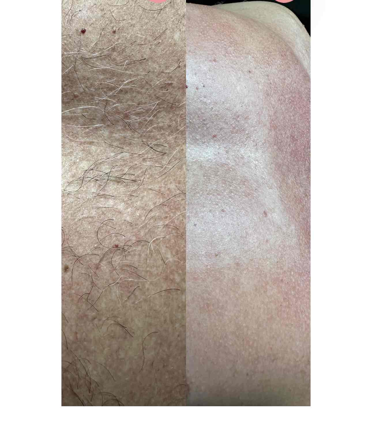  skin-care,before-after,comparison,treatment 