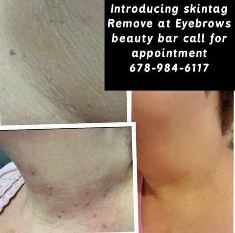 gallery image in our gallery