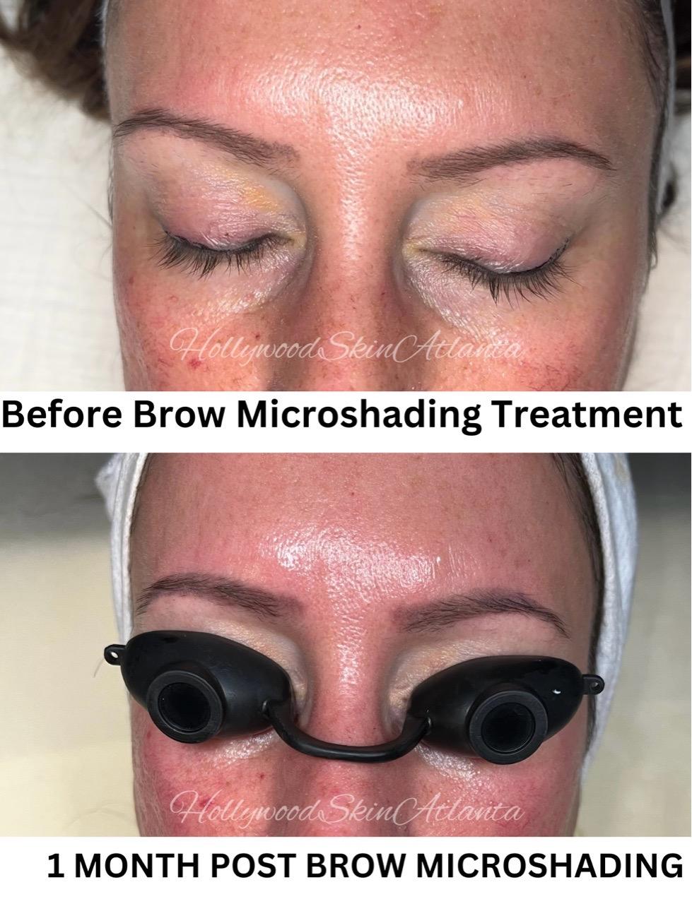  brow,microshading,beauty,treatment,before and after  