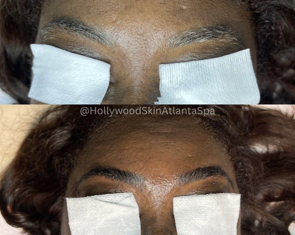  eyebrows,before-after,cosmetic,beauty,skincare  