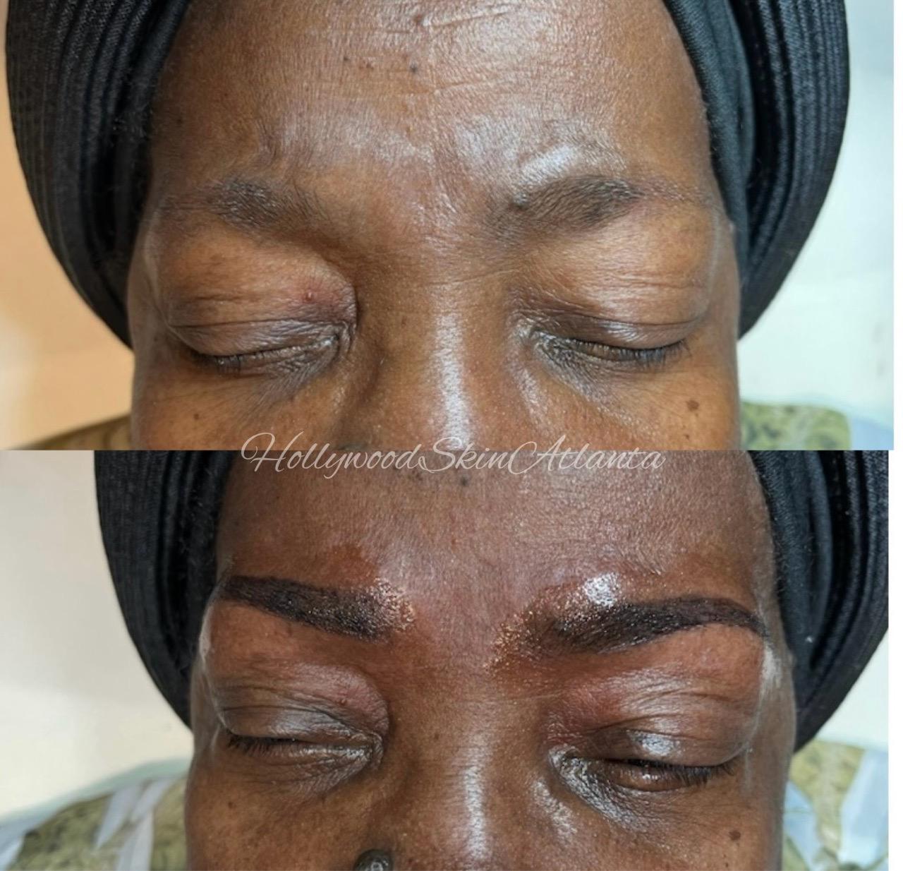  eyebrow,cosmetic,before-and-after,skincare  