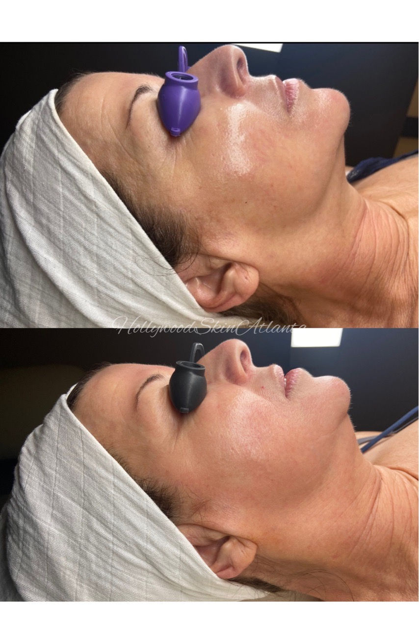  skincare,facial,spa,beauty,wellness,treatment  