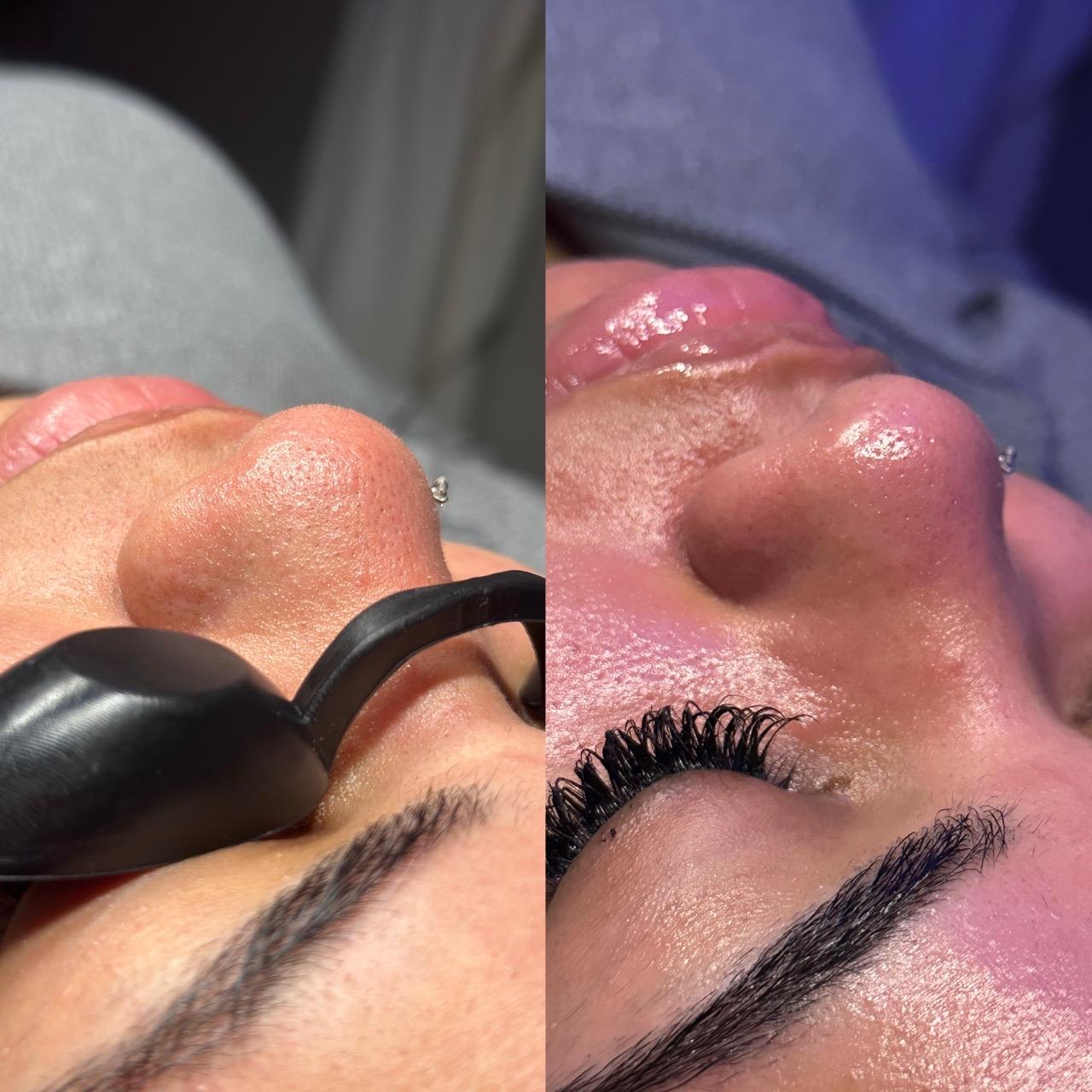  before and after,beauty treatment,eyelash extension,skincare 