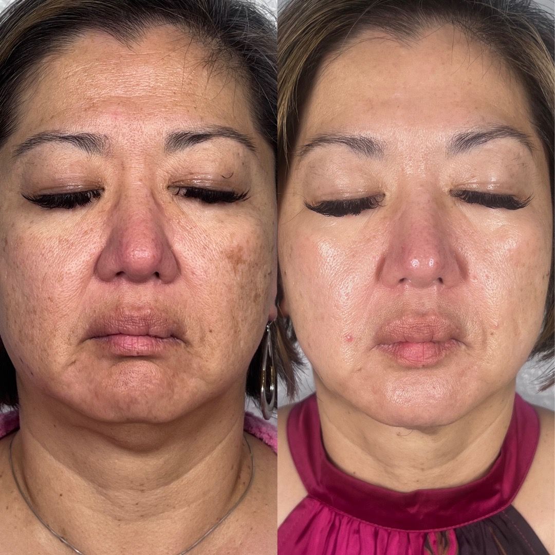  before-and-after,skin-care,beauty,transformation,female  