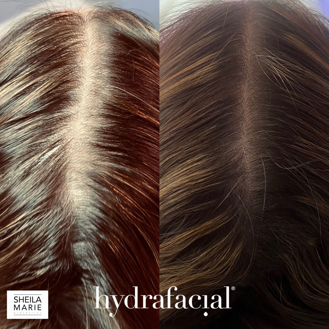  hair,scalp,comparison,treatment,result,branding  
