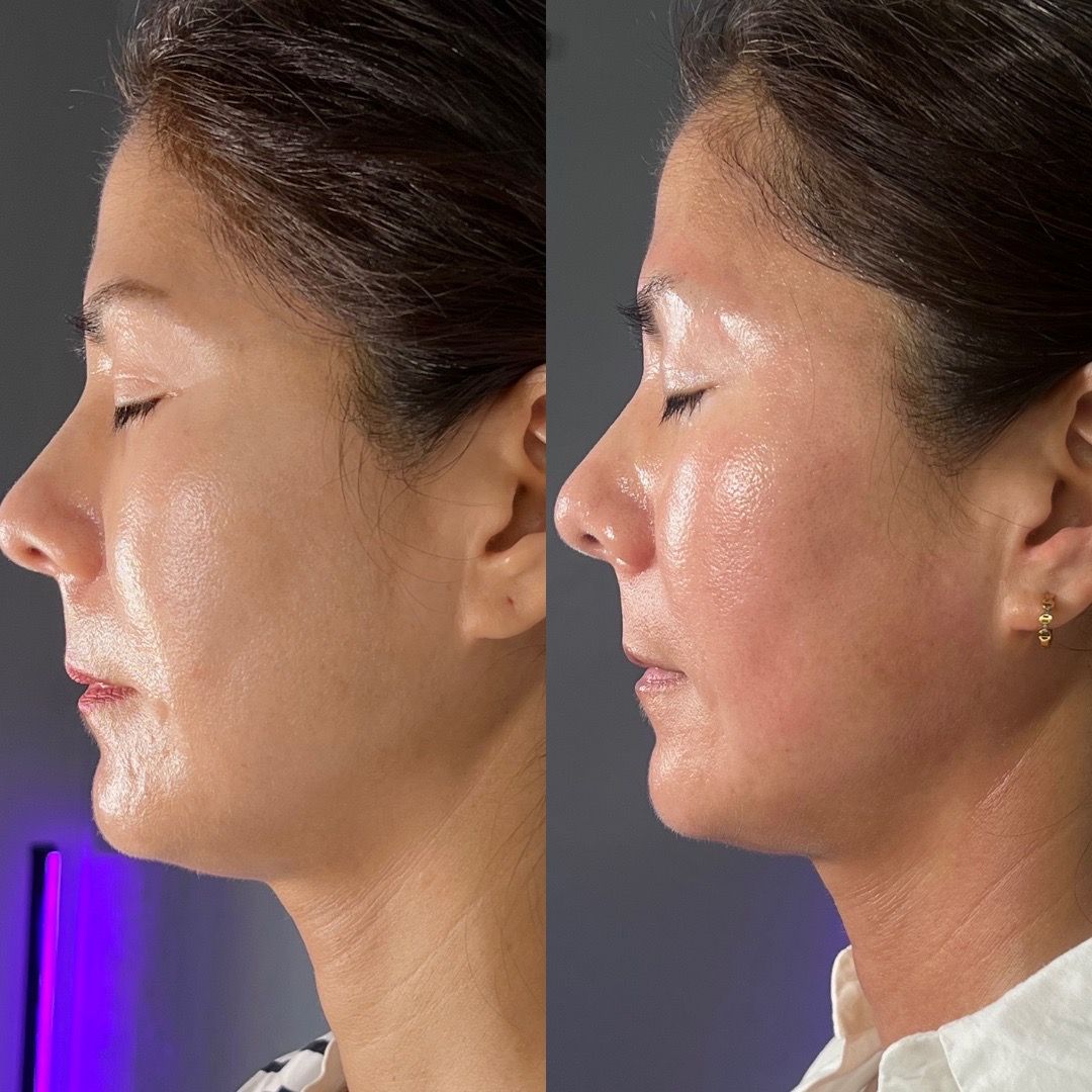  skin,face,transformation,comparison,before-after  